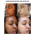 5D Gluta Capsules - Manufacturer Dark Spot Corrector Vitamin E Remove Melanin Pills