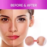 5D Gluta Day Night Cream - Manufacturer Dark Spot Corrector Remove Melanin Knuckle