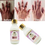 Knuckle Peeling Set - Manufacturer Miracle 7 Days Alpha Arbutin Dark Elbow Africa