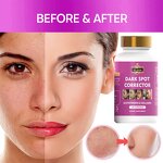 5D Gluta Capsules - Manufacturer Dark Spot Corrector Vitamin E Remove Melanin Pills