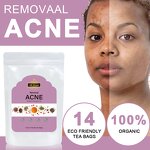 Beauty Tea Bag - Manufacturer Hot Sell Organic All-Natural Detox Glow Skin Whitening