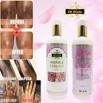 Knuckle Peeling Lotion - Manufacturer Miracle Whitening Elbow Knee Half Cast 500ml