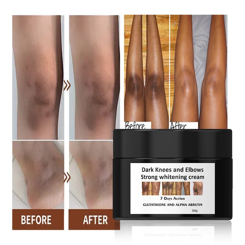 Whitening Face Cream - Manufacturer Vitamin C Collagen Rice Dark Spot Remover Bleaching