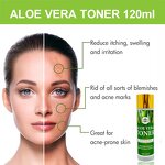 Aloe Vera Toner - Manufacturer OEM Private Label Repair Itching Swelling Acne Scar
