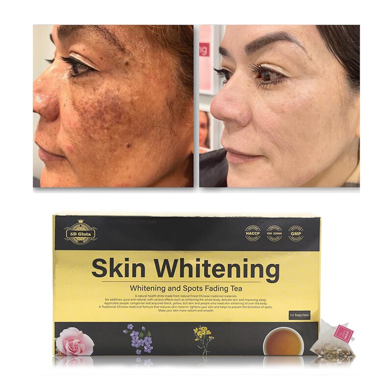 Spots Fading Tea - Manufacturer Natural Herbal Best Organic Skin Lightening Whitening