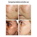 Collage Cream - Manufacturer OEM Private Label White Extra Blanchissant Hydratant