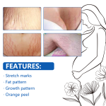 Stretch Mark Oil Manufacturer - Organic Skin Care Bulk Supply