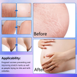 Stretch Mark Oil Manufacturer - Organic Skin Care Bulk Supply