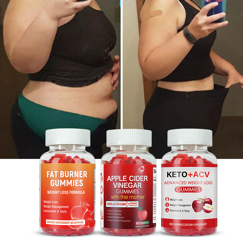 Apple Cider Vinegar Gummies Manufacturer - Natural with The Mother