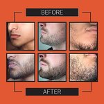 Beard Growth Gummies - Manufacturer Private Label Vitamin Gummy Candy Hair Beard Men