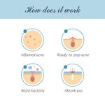 Acne Patches Manufacturer - Transparent Hydrocolloid Organic CE Certified 36 Patches