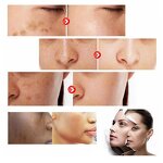 Glutathione Capsule Manufacturer - High Quality 1000mg Organic Skin Whitening with Collagen & Vitamin C