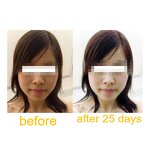 L-Glutathione Capsules Manufacturer - OEM Reduced with ALA Vitamin C or Grape Seed Extract