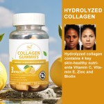 Collagen Vitamin Gummies Factory - OEM Lemon Skin Care Soft Gummy