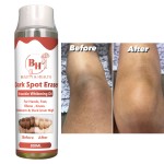 深色指关节提亮油生产商-斑点去除身体油