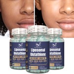 Liposomal Gummies Supplier - OEM ODM Sugar Free Skin Whitening