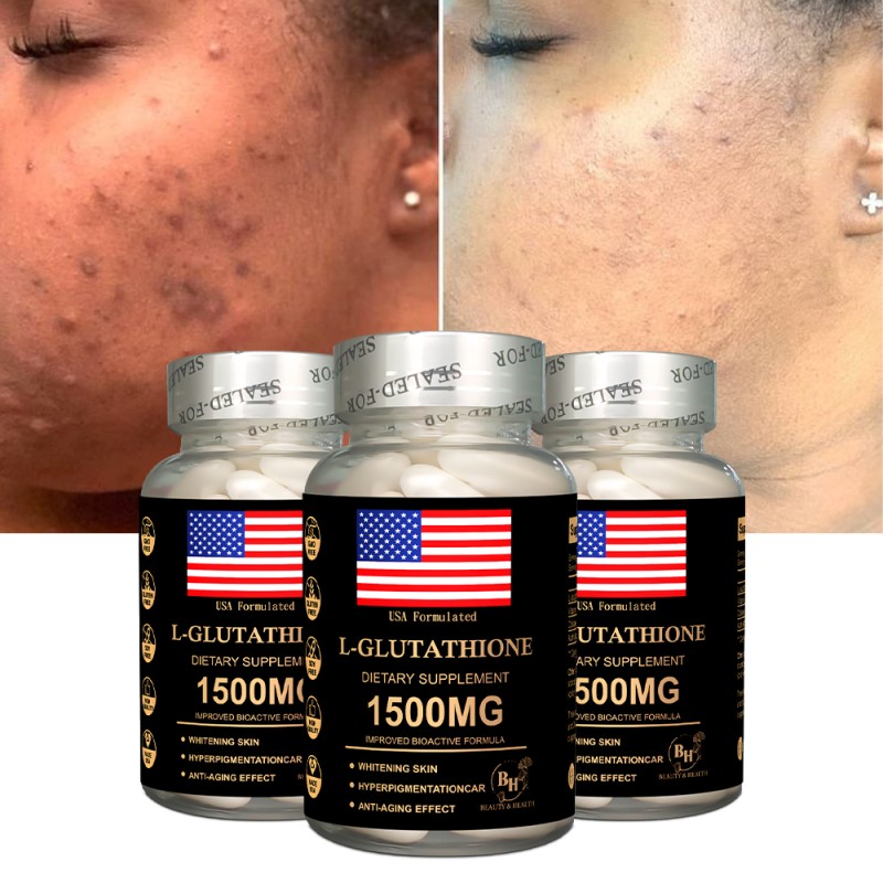 Skin Whitening Capsules Factory - OEM ODM 1500mg Collagen Vitamin