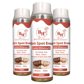 指关节美白霜供应商-深色皮肤肘部膝盖精华代工