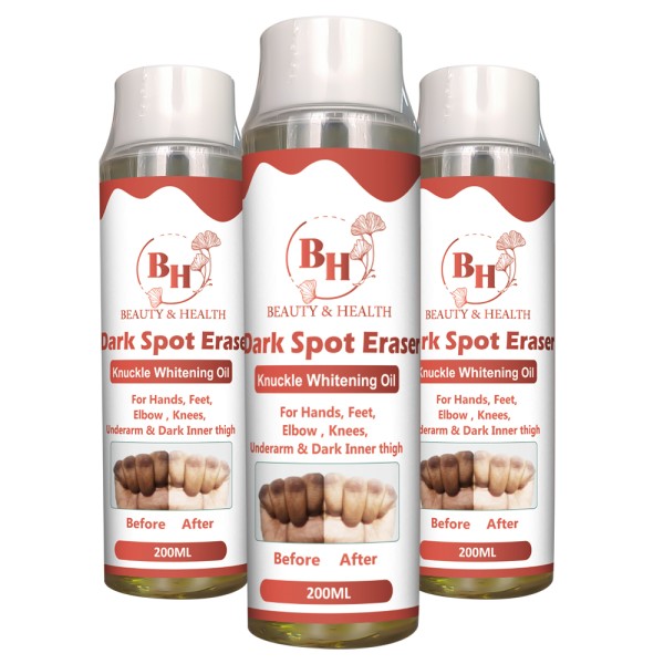 指关节美白霜供应商-深色皮肤肘部膝盖精华代工