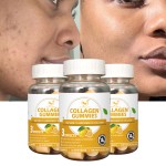 Collagen Vitamin Gummies Factory - OEM Lemon Skin Care Soft Gummy