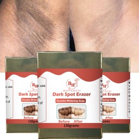 Knuckle Whitening Soap Supplier - Wholesale Dark Spot Removal Soap