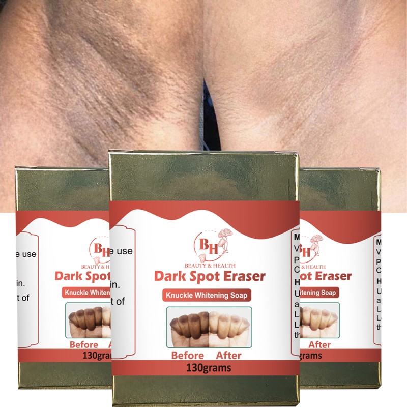 Knuckle Whitening Soap Supplier - Wholesale Dark Spot Removal Soap