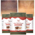 Knuckle Whitening Soap Supplier - Wholesale Dark Spot Removal Soap