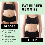 Fat Burner Gummies Manufacturer - OEM ODM Women's Curves Beauty