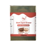 Knuckle Whitening Soap Supplier - Wholesale Dark Spot Removal Soap