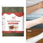Knuckle Whitening Soap Supplier - Wholesale Dark Spot Removal Soap