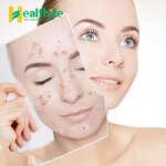 Nigella Sativa Extract Manufacturer - Natural High Concentrate Thymoquinone for Hair