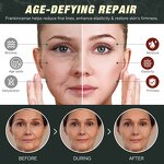 Tallow Balm Manufacturer - 120g Frankincense Castor Oil Grass Fed Anti-aging