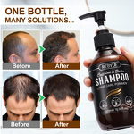 Hair Shampoo - Wholesale 300ml Bioton Caffeine Hair Loss Prevent Growth