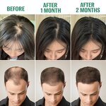 Hair Oil Spray - 120ml Natural Batana Rosemary Fast Hair Growth Scalp Care