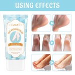 Repair Cream - 3 Days Hand Foot Whitening Cracked Dry Skin Moisturizing