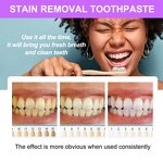 Toothpaste Manufacturer - Press-Type Baking Soda Instant Teeth Whitening Stain Remover