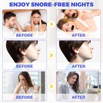 Sleep Strip Manufacturer - Black Lip Shaped Hypoallergenic Anti Snoring Breathing