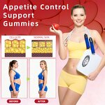 Gummy Manufacturer - Private Label Keto Acv 1500mg Apple Cider Vinegar Weight Loss