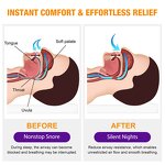 Anti Snoring Spray - Wholesale Natural Throat Breathing Relief Nasal Mist for Men Women