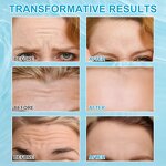 Wrinkle Patch - Wholesale 12 Patchs Collagen Silicone Forehead Anti Wrinkle Remover