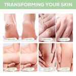 Urea Cream Manufacturer - 40% Urea Dry Cracked Heels Knees Elbows Salicylic Acid