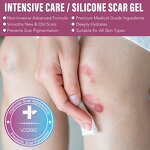 Scar Gel Manufacturer - Premium Skin Care Scar Removal Pimples Acne Silicone Gel
