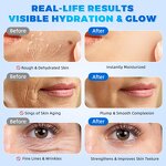 Serum Manufacturer - 3% Hyaluronic Acid 24H Moisturizing Anti Wrinkle Whitening