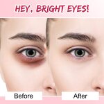 Eye Pad Manufacturer - Wholesale 100 Pairs Anti-Puffiness Hydrogel Eyelash Extension