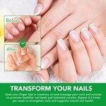 Rosemary Oil - Wholesale 100% Pure Organic Scalp Nourishing Hair Growth