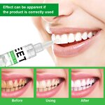 Teeth Whitening Pen - Wholesale Professional Dazzling White Gel Pen for Teeth