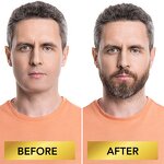 Beard Growth Kit - Organic Serum Derma Roller Grooming Set for Black Men