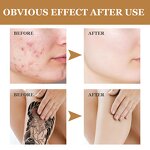 Concealer Cream - Invisible Tattoo Scar Birthmark Stretch Long Lasting Waterproof