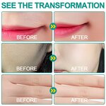 Dermaplaner Spray - OEM Hair Removal Custom Logo Body Face Shaving Set