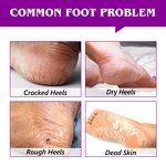 Foot Balm Manufacturer - Professional Deep Moisturizing Cracked Heel Repair Stick
